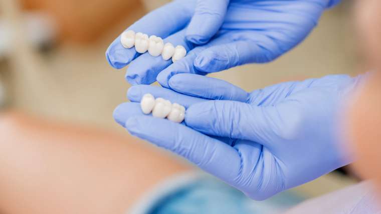 Veneers | Lambton Dental